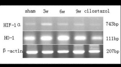 Hypoxia-Inducible Factor-1α