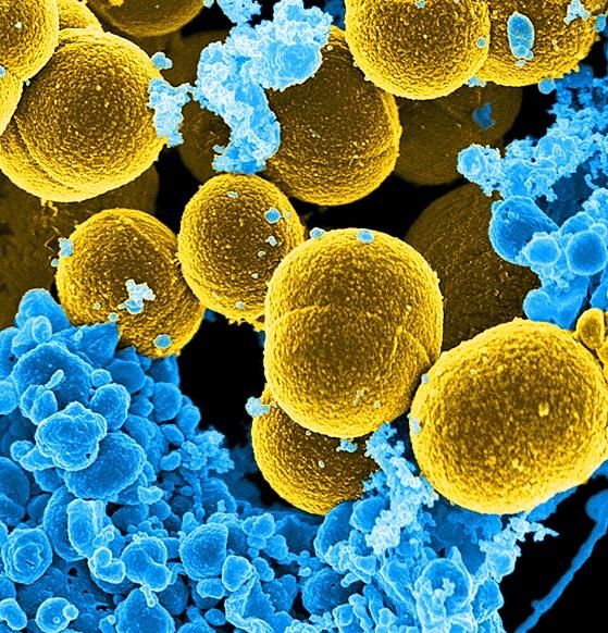 <i>Staphylococcus aureus</i> Bacteria