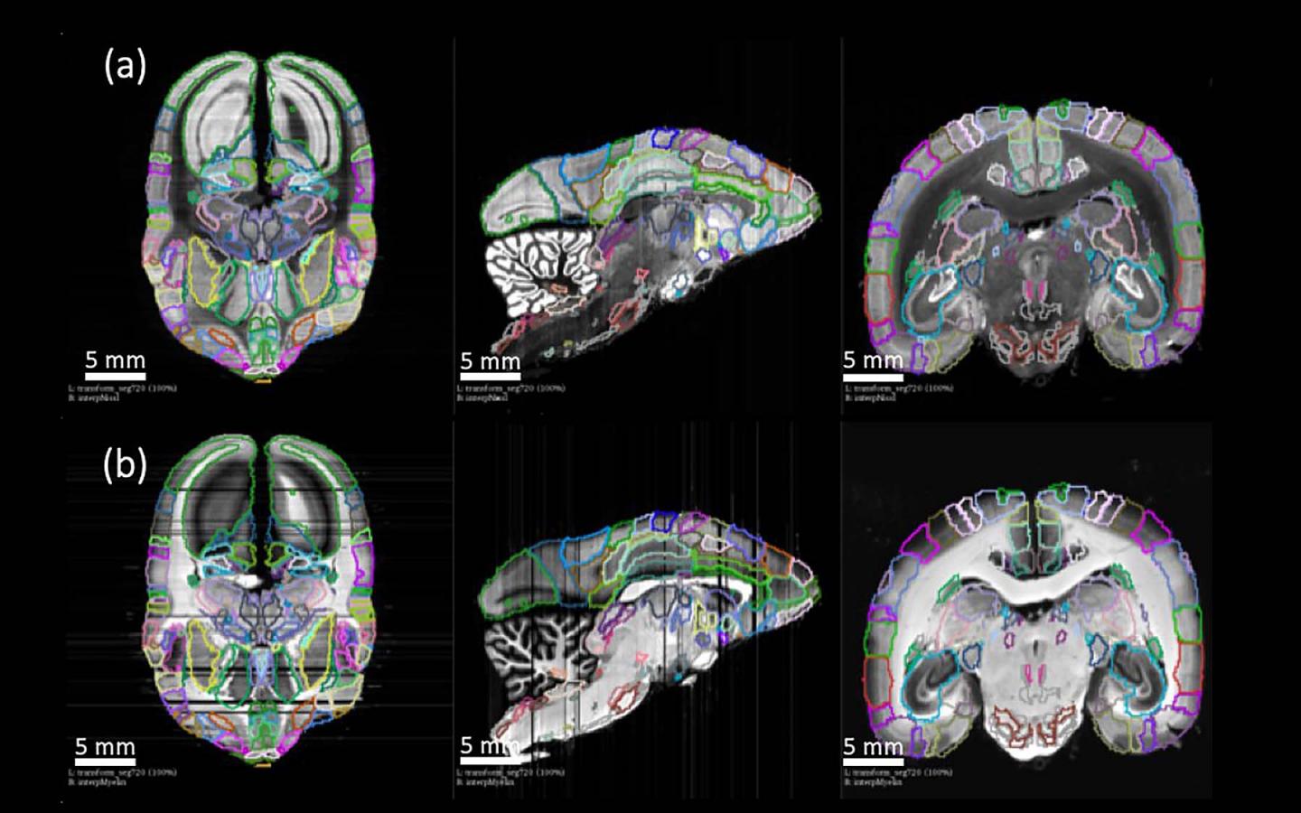 Neural Connections Map