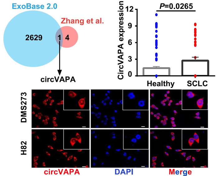 Novel Functions of CircRNA Found in Small Cell Lung Cancer