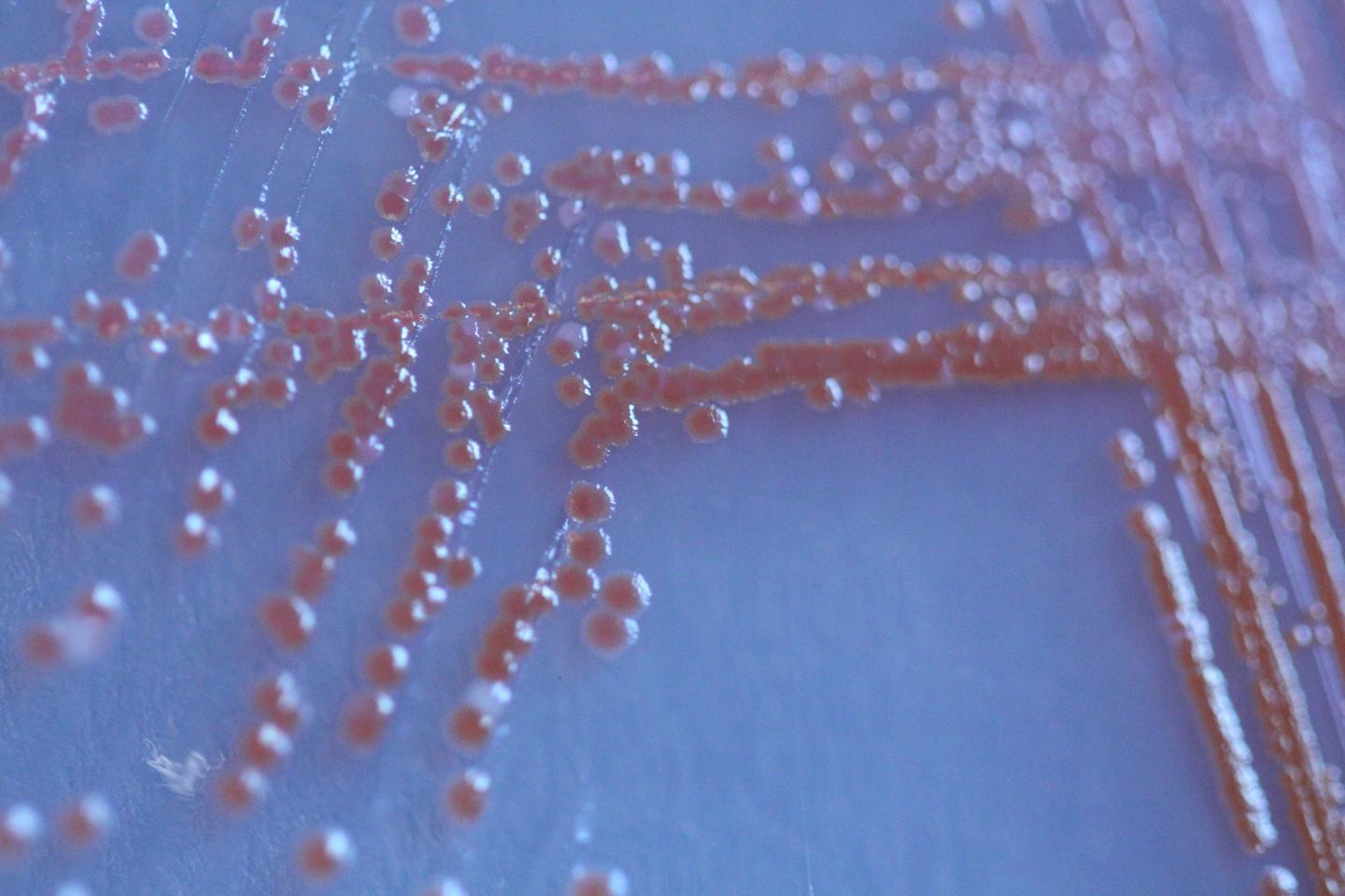 Serratia marcescens [IMAGE] EurekAlert! Science News Releases