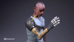 Cleveland Clinic Researchers Develop Bionic Arm that Restores Natural Behaviors in Patients with Upper Limb Amputations