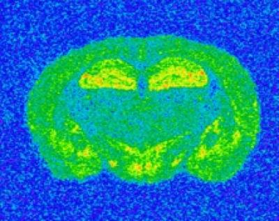 Autoradiographic Image of a 7 Nicotinic Recepter in a Mouse Coronal Brain Section