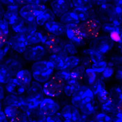 Chimera: Kaposi Virus with LANA Protein