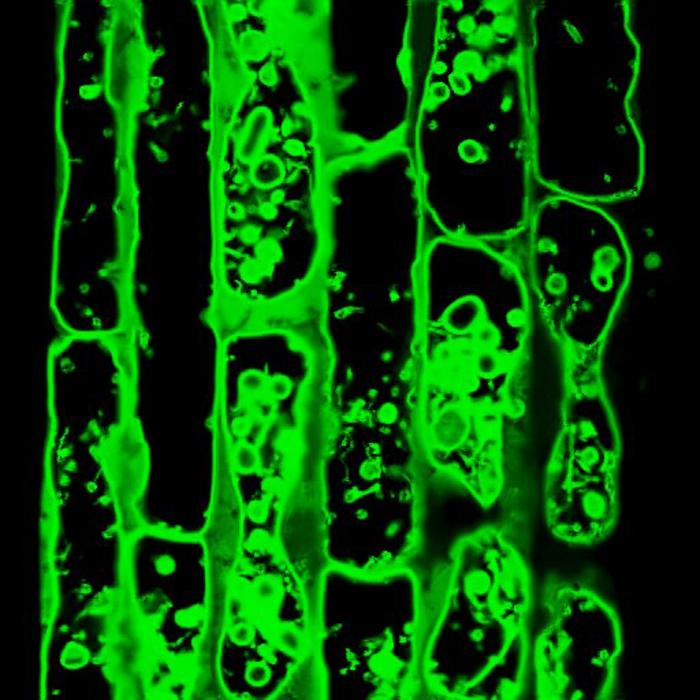 Confocal micrograph of root cells in Arabidopsis thaliana highlighting the re-localization of GFP-ATG8 to the tonoplast upon cell wall damage.