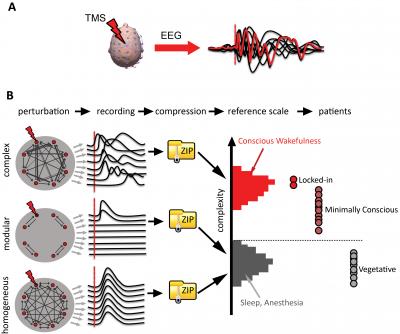 Brain Complexity Offers Clues to Levels of Consciousness (2 of 3)