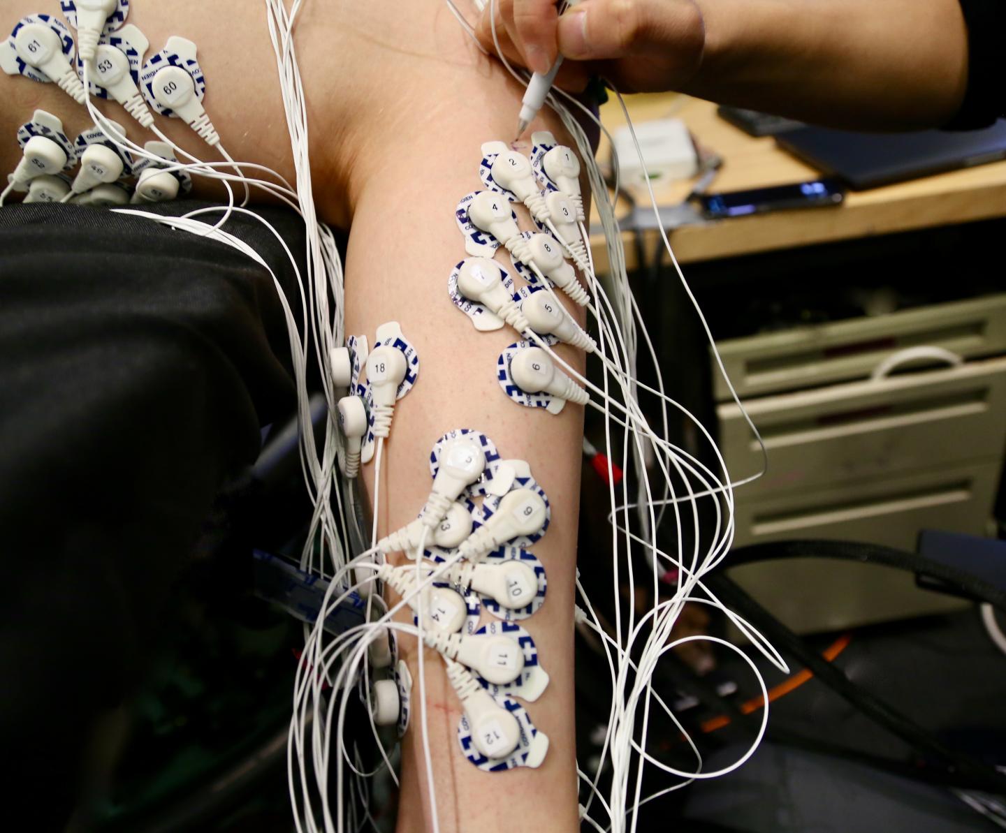 Neuromuscular mapping