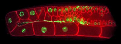 <i>C. elegans</i> Gonad