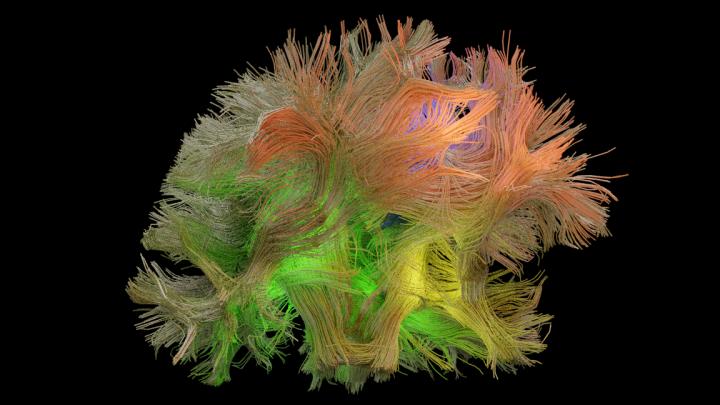 Brain with its fibers showing its immense complexity