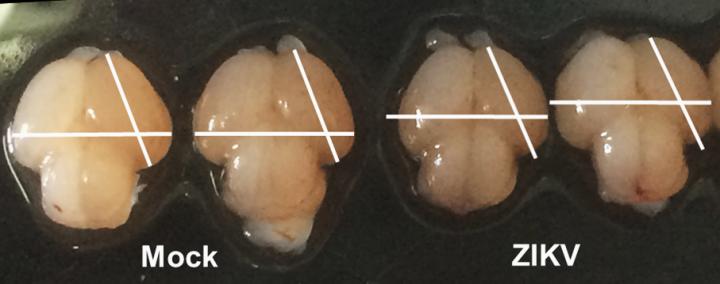 Zika-Infected vs. Uninfected Fetal Mouse Brains