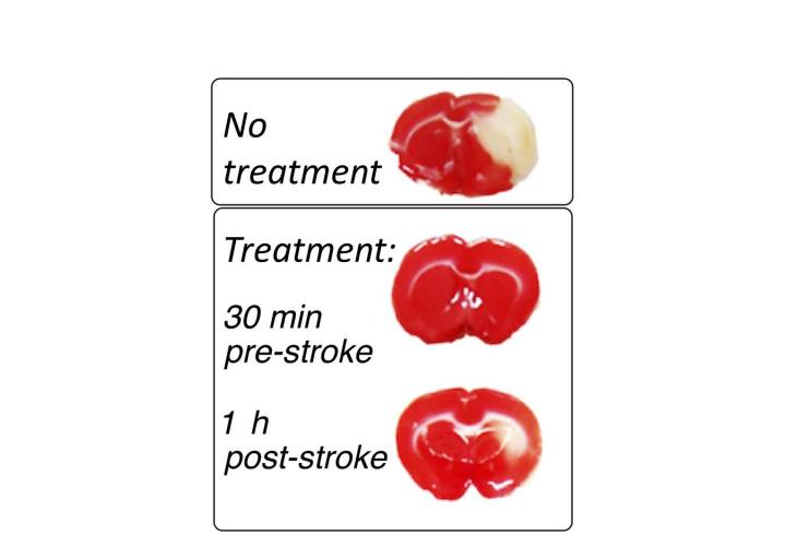 New Compound Reduces Stroke Damage