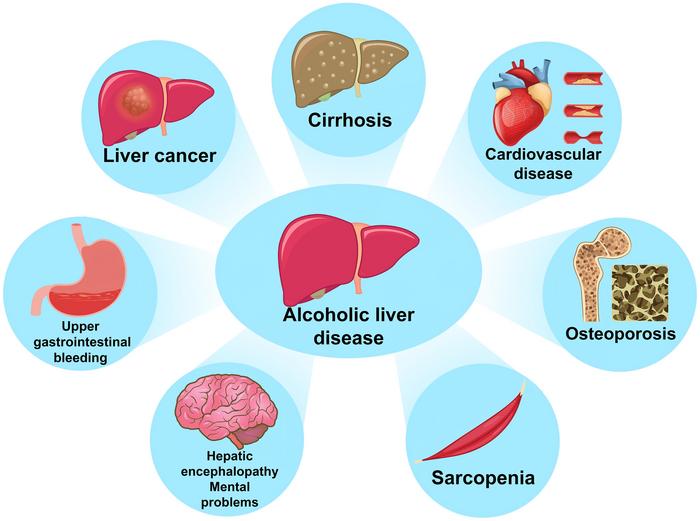 Complications associated with alcoholic liver disease