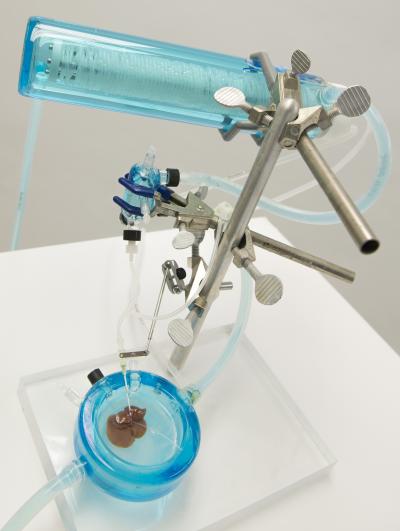 Machine Perfusion System