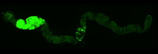 Tumor Growth in <i>Drosophila</i> Gut