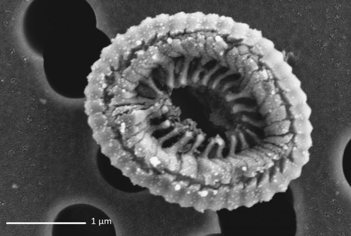 scanning electron microscope virus