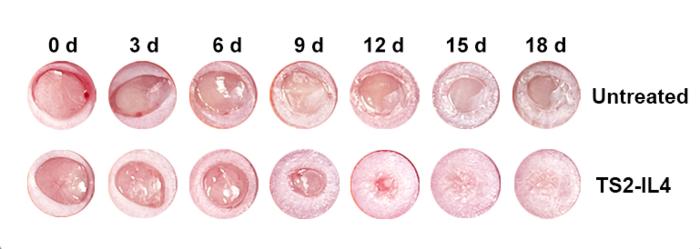 Nano Drug Accelerates Diabetic Wound Healing in Mice