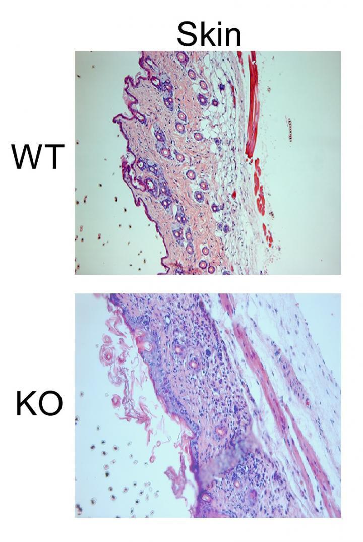 Salk Researchers Discover that Cutting off Energy Production in Regulatory T Cells Impairs their Fun