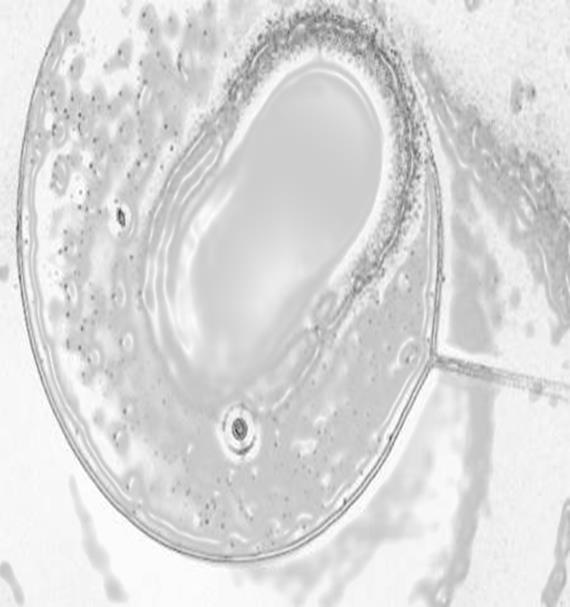 Extracting RNA From a Single Cell