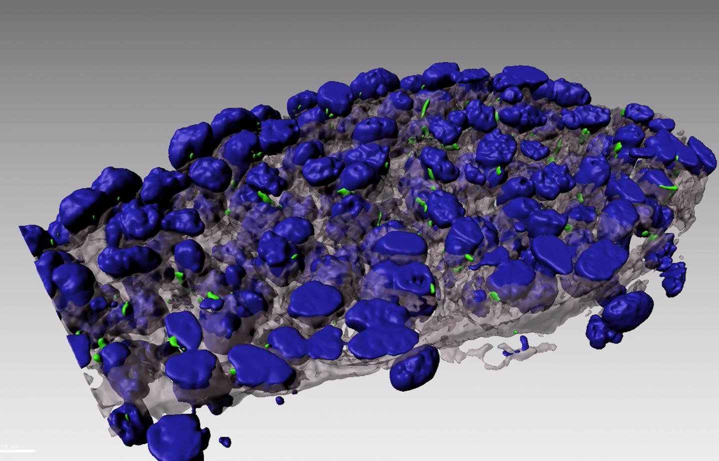Defects in Cellular Antennae Can Cause a Common Heart Condition (1 of 3)