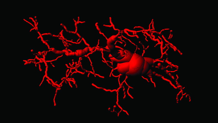 An activated microglial cell in the brain of cGAS/STING activated mice.