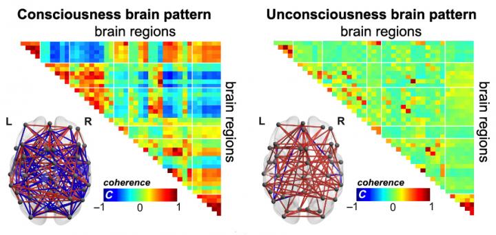 Brain Patterns Indicative of Consciousness, in Unconscious Individuals