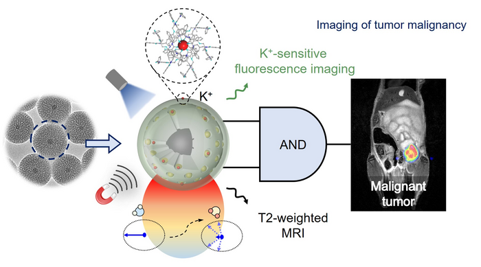 KDMN-based 'AND' logic MRI-FI dual-mode imaging for identification of tumor malignancies