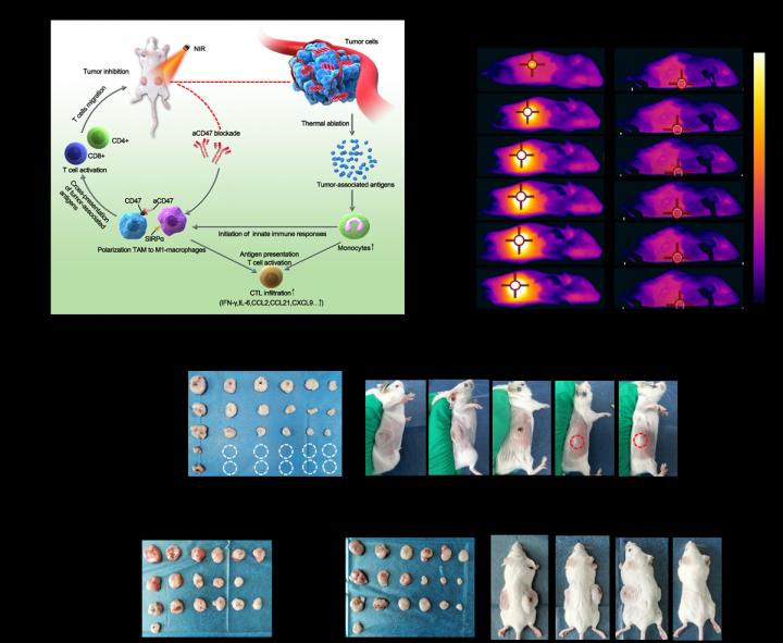 Anti-Tumor Effect Of BP Based Photothermal Therapy With aCD47