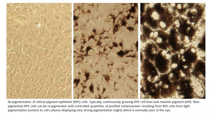 Re-pigmented RPE Cells