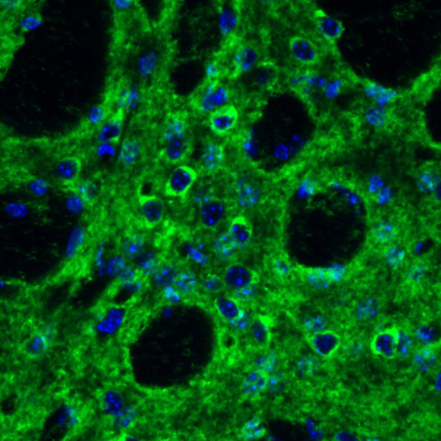 IL-6 Regulation in the Striatum