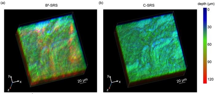 Figure 3 | B²-SRS deep tissue imaging of porcine brain.