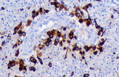 Invasive Trophoblasts Surrounding and Invading Maternal Cells