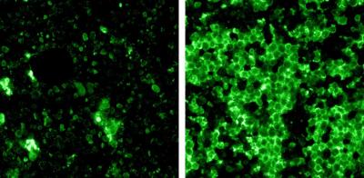 Test for p53 Needed to Prescreen Blood Cancer Patients