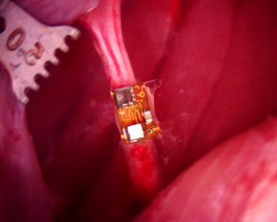 StimDust on a mouse sciatic nerve