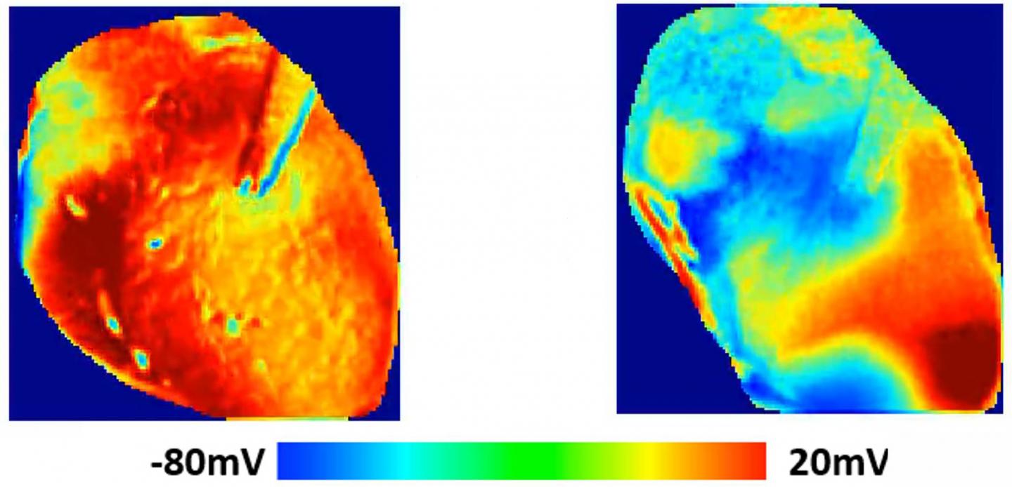 Voltage Surface on Heart - 2
