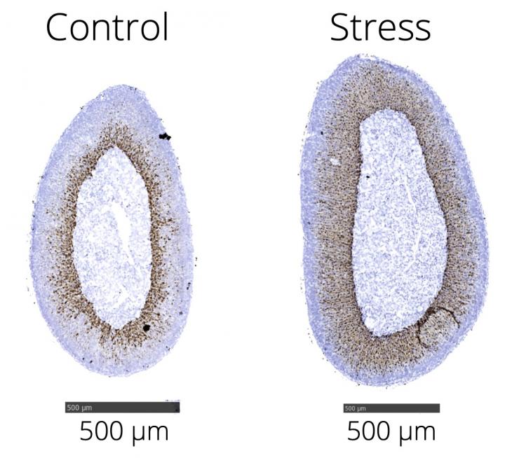Stress on Every Cell