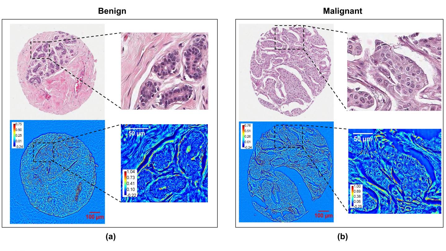 Comparison of Stained and Unstained Images in Breast Cancer Diagnosis