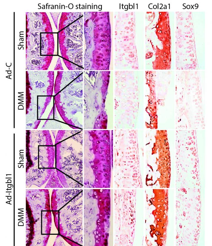 Cell Receptor Signaling Gone Awry Underlies Joint Degeneration in Arthritis (2 of 2)