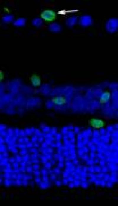 Inhibition of Nogo Receptor