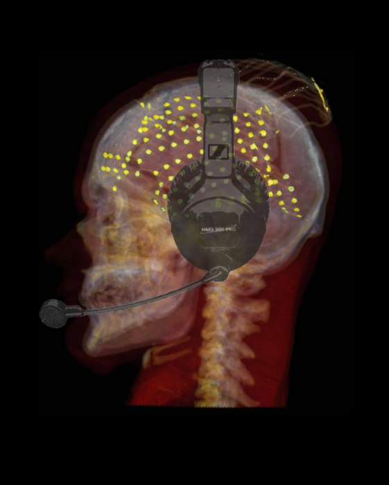 Fluent speech is guided by a sensorimotor error-detection network in the brain