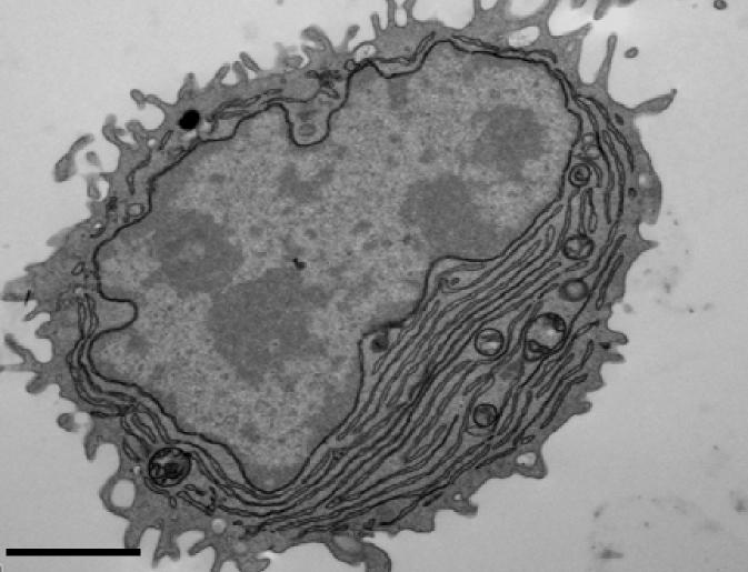 Plasma Cell Visualized by Electron Microscopy