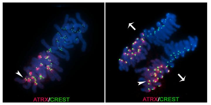 Fluorescence Microscopy of Maternal and Paternal Chromosomes