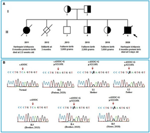 Heterozygous mutation (c.6353C > G) in the ABCA12 gene