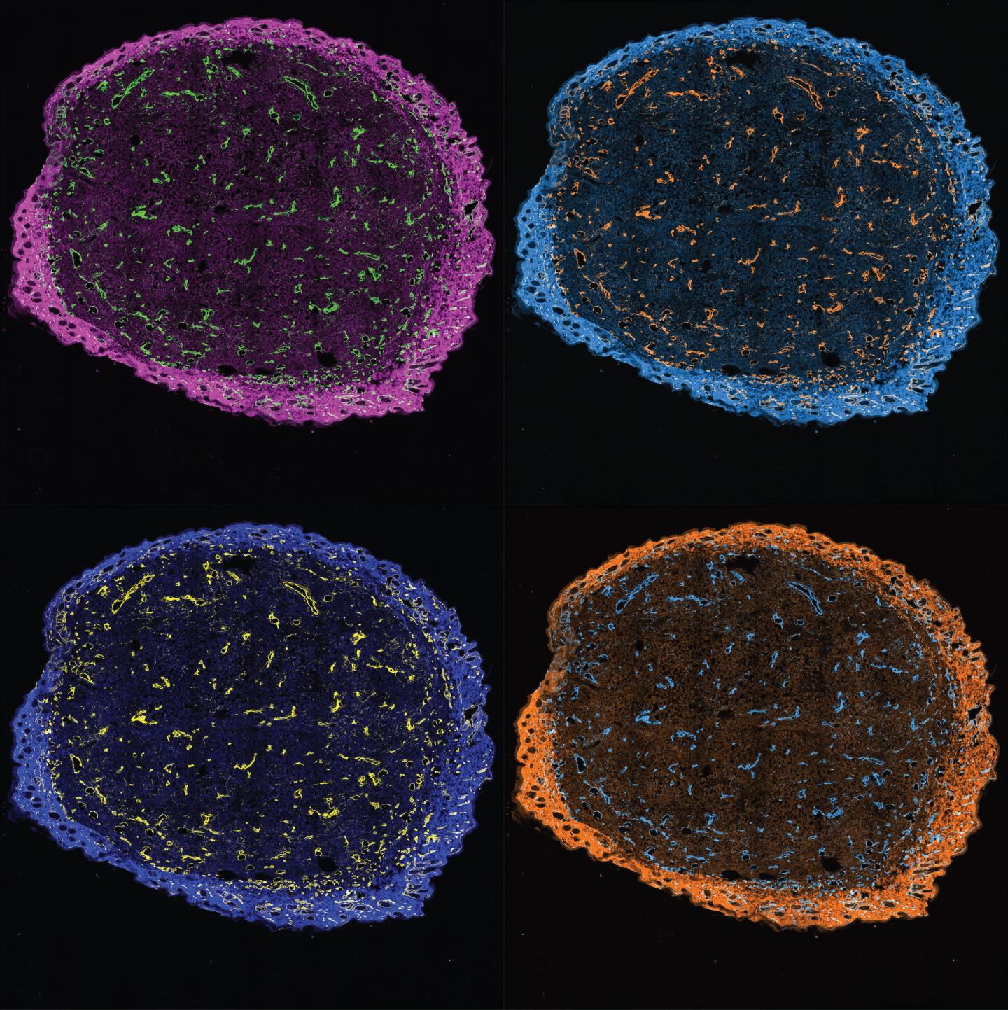 Collagen 'Anchors' Make Combination Immunotherapies Safer and More Effective in Mice (1 of 4)