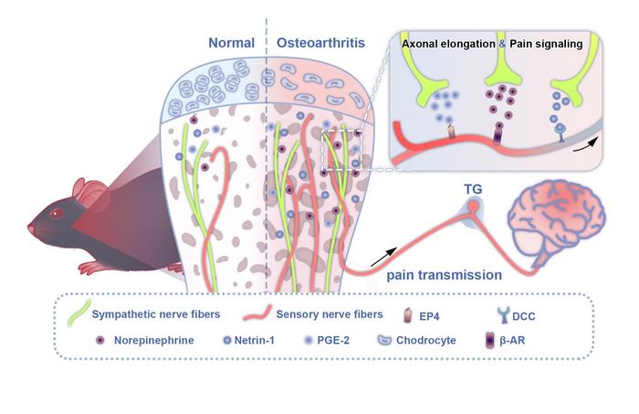 Schematic depicting the involvement of regional sympathetic nerves in the mediation of pain in early-stage TMJ-OA