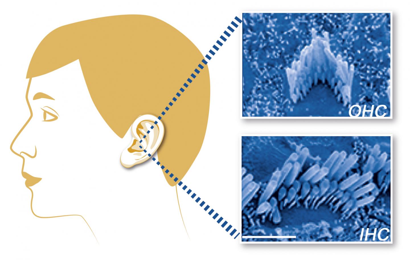 Wbp2 is a Novel Deafness Gene