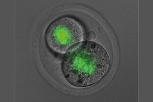 SMCHD1 embryo