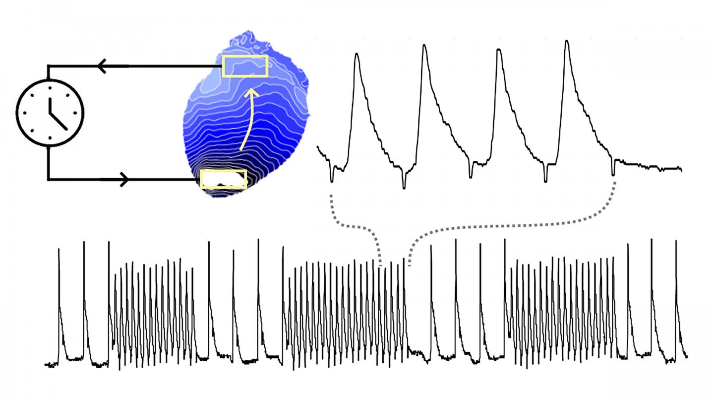 Investigation of Abnormally Rapid Heart Rhythms