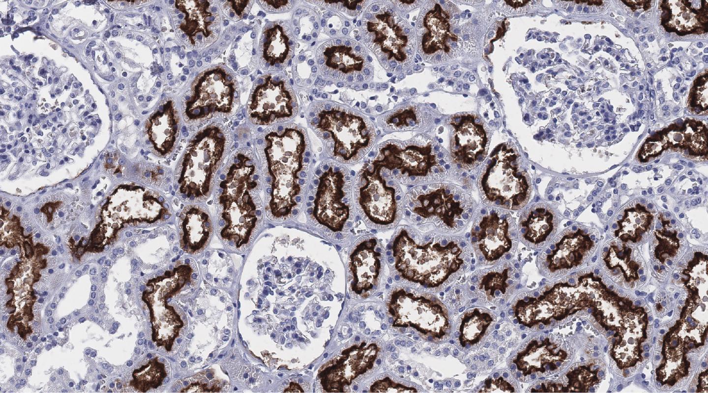 ACE2 Expressed in the Kidney