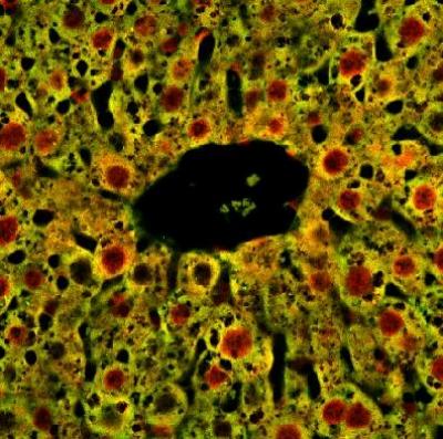 New Role for a 'Foxy Old Gene'