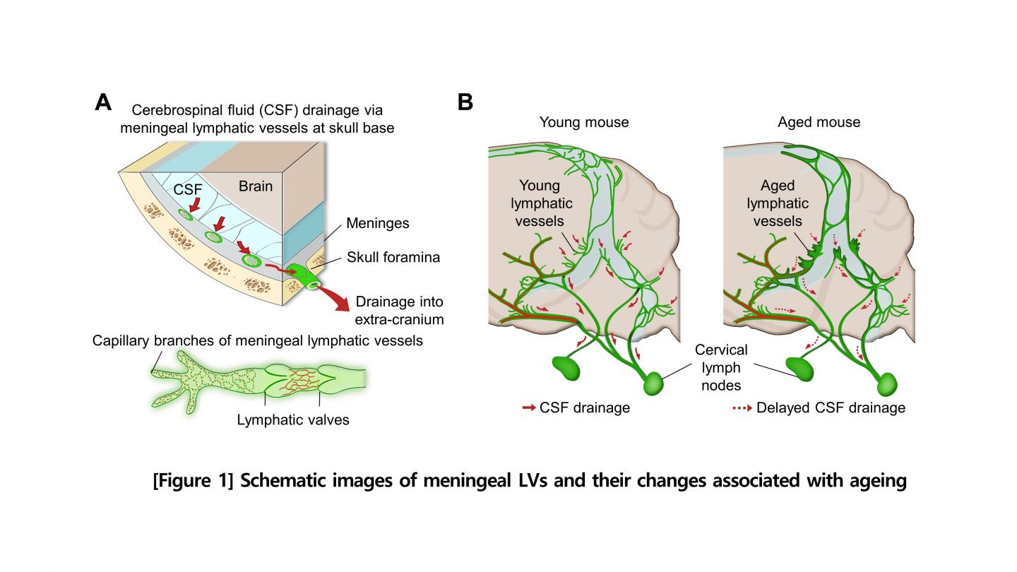 Figure 1: Schematic Images of Location and Features of Meningeal Lymphatic Vessels and Their Changes